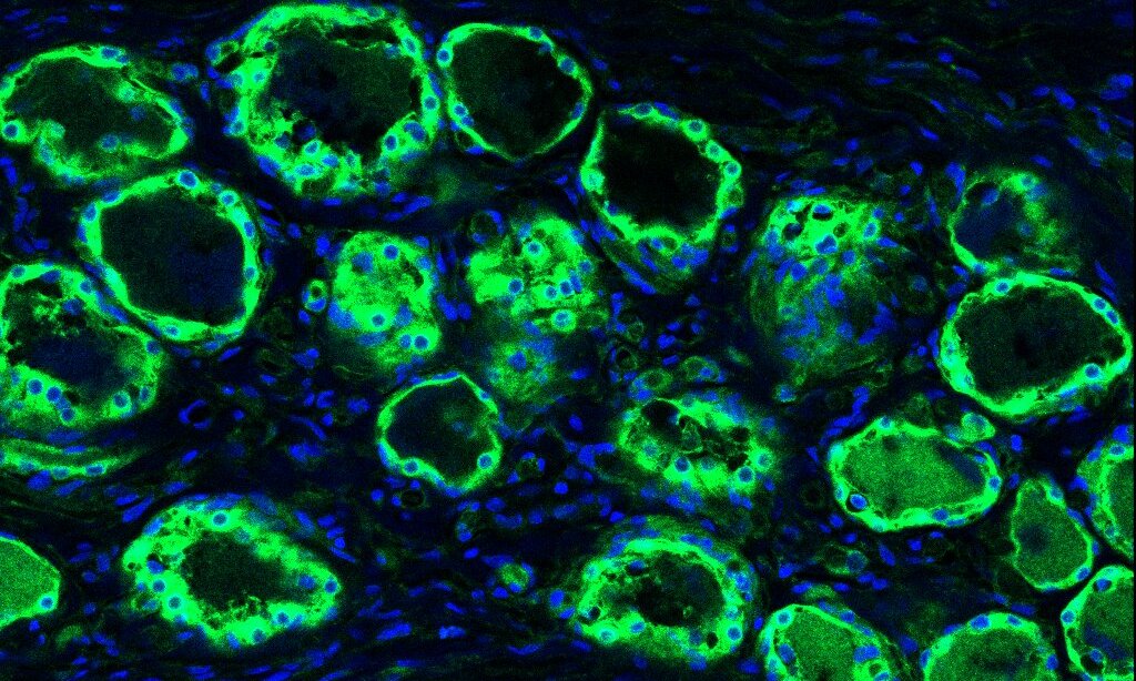 Immunohistochemistry (IHC) in human dorsal root ganglia; 20x magnification.