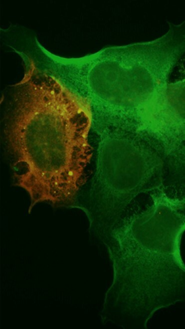 Närbild på en viruscell