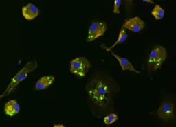 Human monocyte-derived macrophages infected with green-fluorescent mycobacteria.