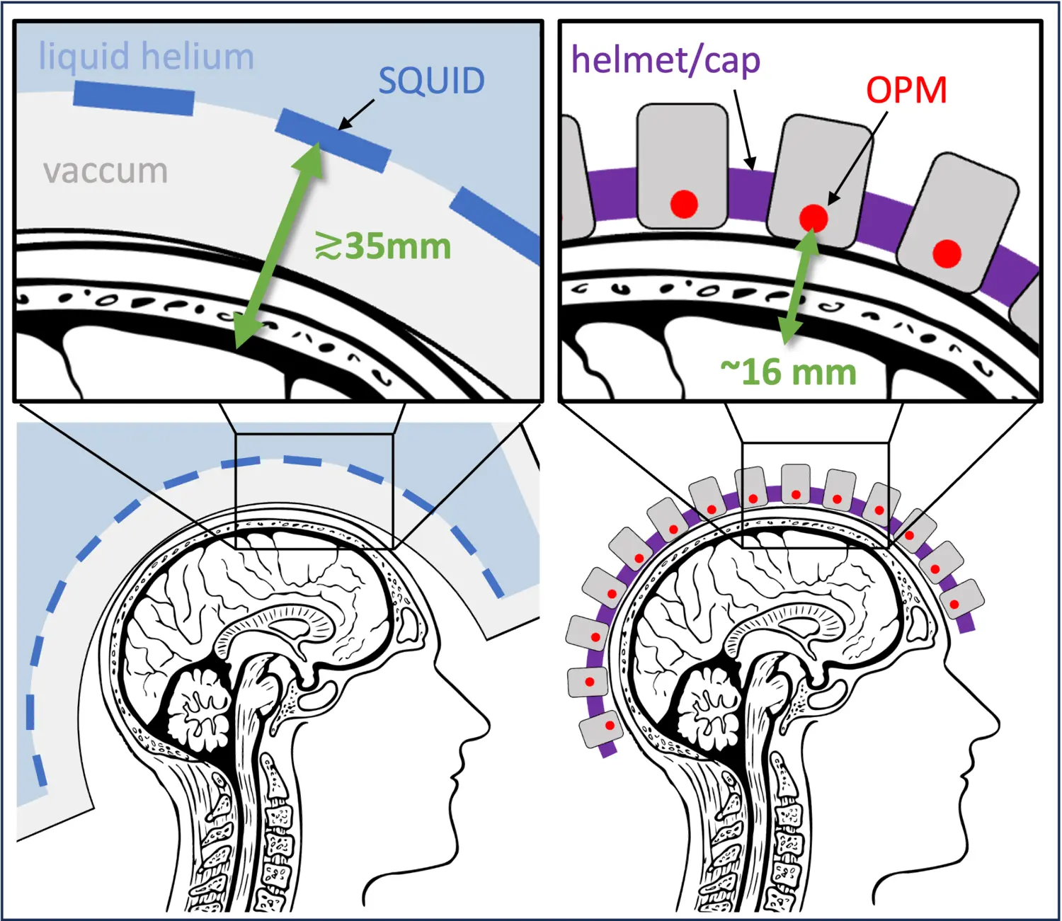 Schematic representation of conventional MEG system using LTS SQUID sensors.