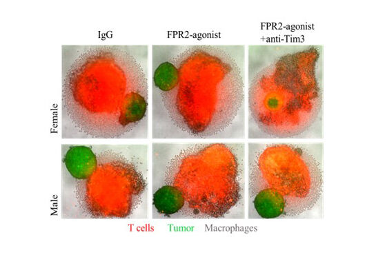 Graphical illustration of Immunotherapy in an artificial 3D tumor microenvironment model.
