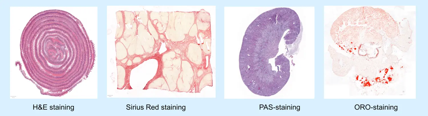 Four examples of staining at FENO.