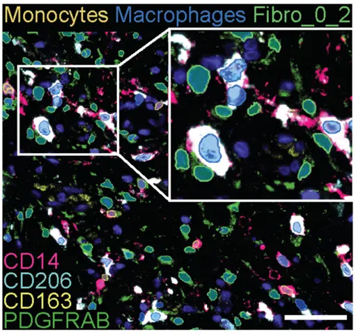 Illustration of fibroblast/monocyte/macrophage interactions in tissue (colon). Image generated from high-plex spatial protein profiling using the MACSimaTM instrument.