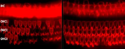 Barbara Canlon group research focus - Nature materials