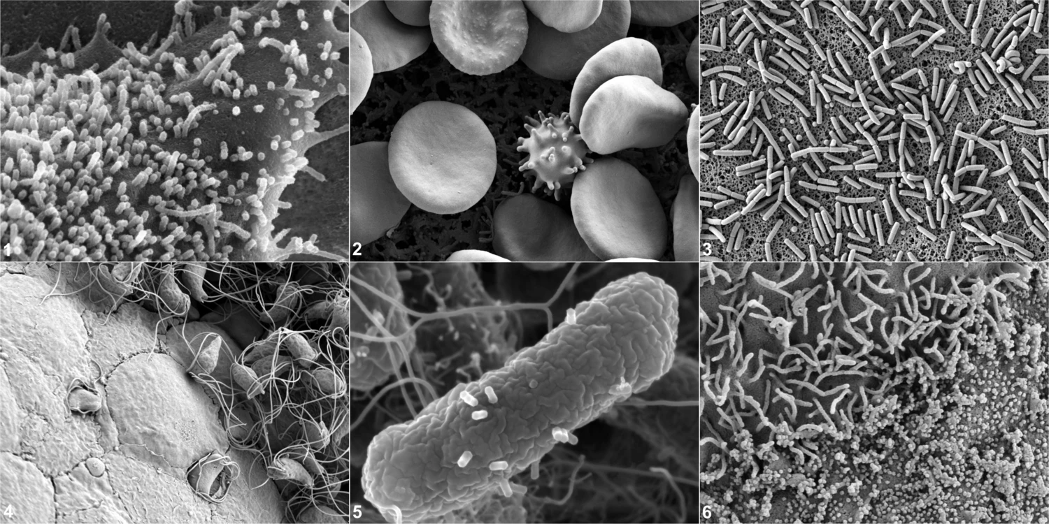Photo of Scanning electron microscopy