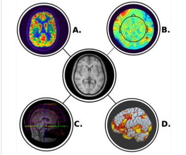 illustration of the methods
