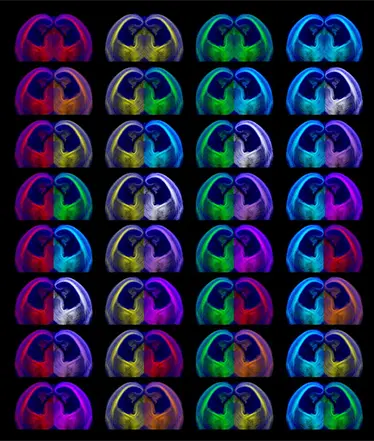 Illustration of Harkany laboratory research focus