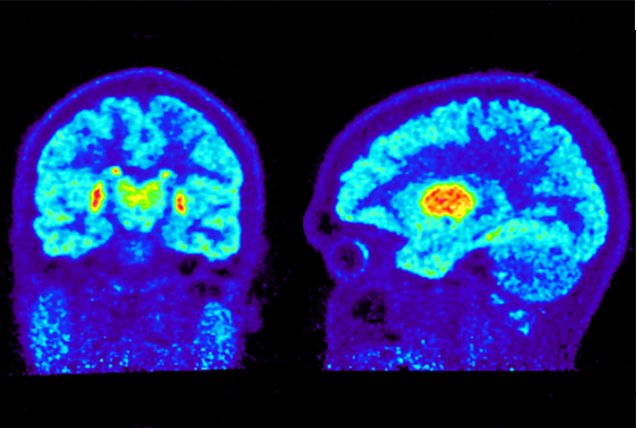 PET, Centrum för psykiatriforskning