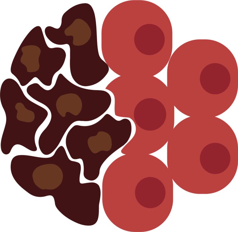 Cancer Cell Invasion