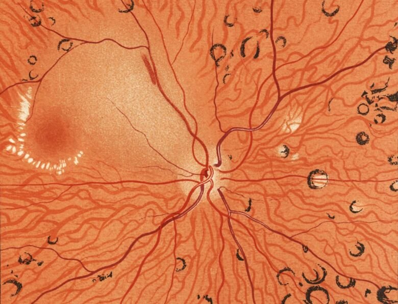 Fundus. Illustration from The Fundus Oculi. W. Adams Frost, 1896