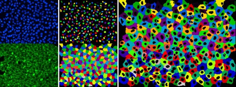 collage of three images created using the image analysis software.