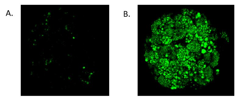 Induktion av steatos med användning av 2 x plasmakoncentration av FFA och induktion av steatos i sfäroiderna under metaboliskt syndromstillstånd. A. Kontrollförhållanden; B. steatotiska tillstånd