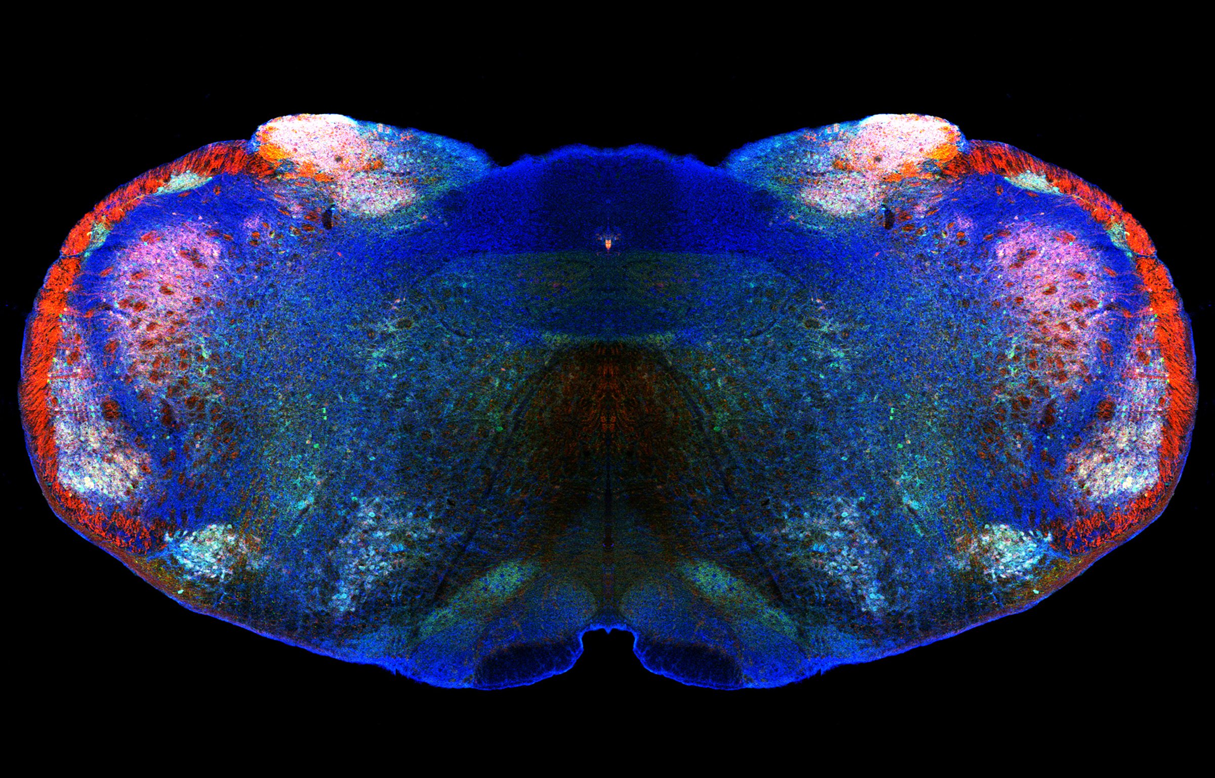 Illustration av hjärnbalk