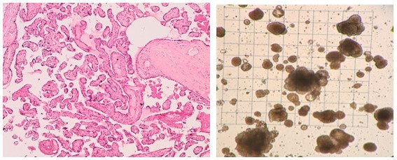 A: Human placenta section with H&E staining showing villous tree morphology. B: Human placental organoid culture
