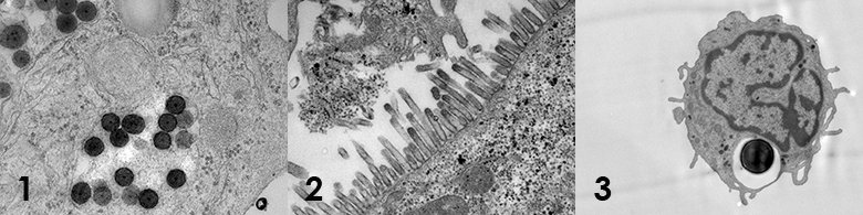 Photos of electro microscopy