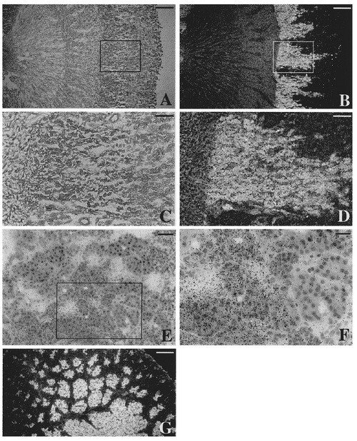 TrxR1 mRNA expression in the rat kidney.