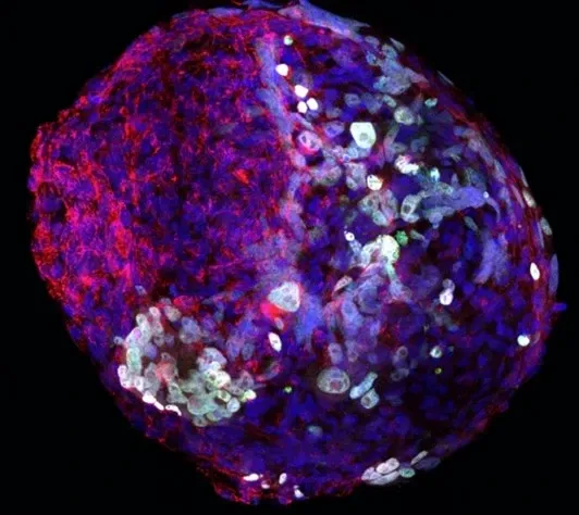 Microscope picture of a hPGCLC sphere culture