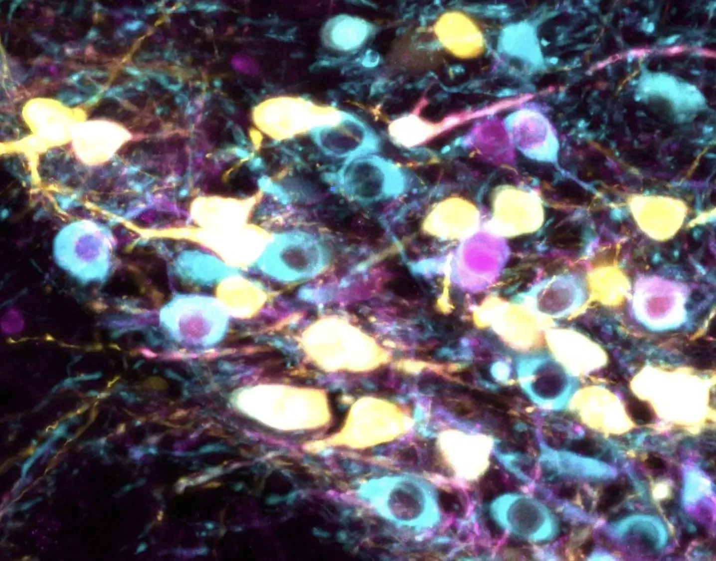 Image from the mouse brain showing genetically labeled sensitive dopamine neurons (yellow signal) epressing the Anxa1 marker (purple signal), compared to all dopamine neurons (blue signal).