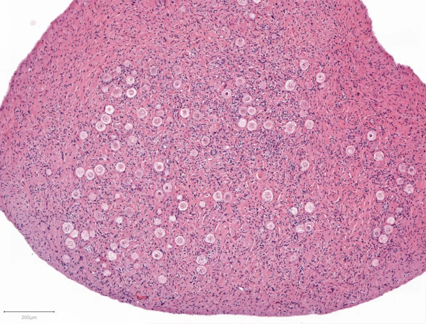 Primordial follicles in human ovarian cortex