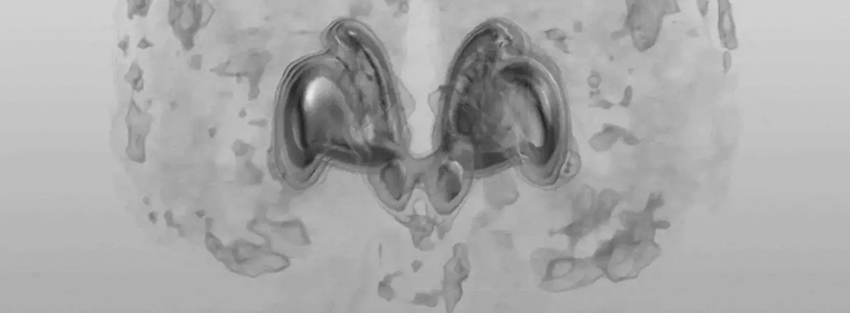 PET, Centrum för psykiatriforskning