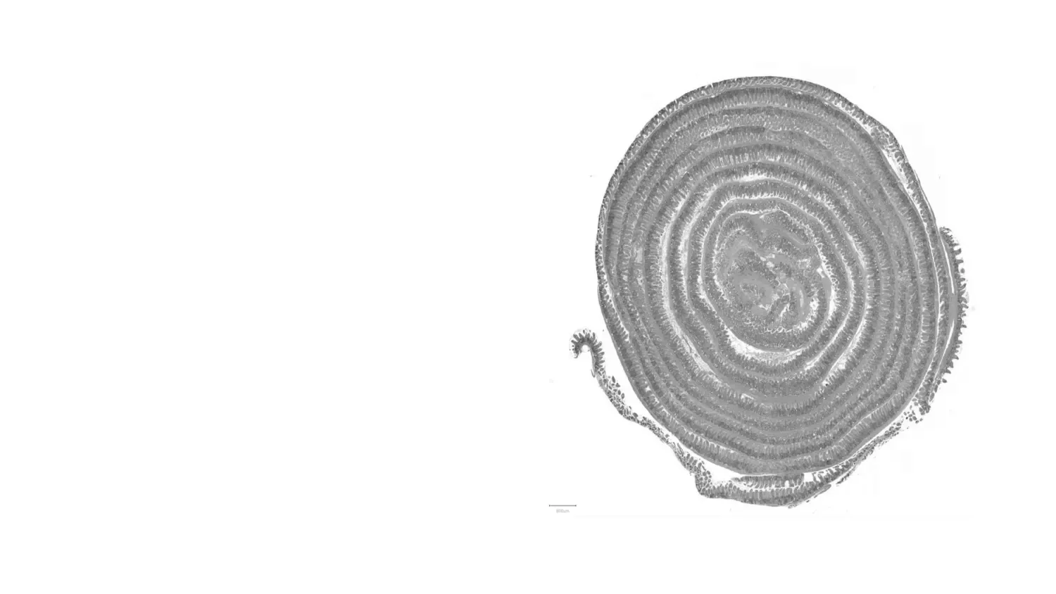 Decorative image for FENO startpage with a pinkish rolled-up round form.