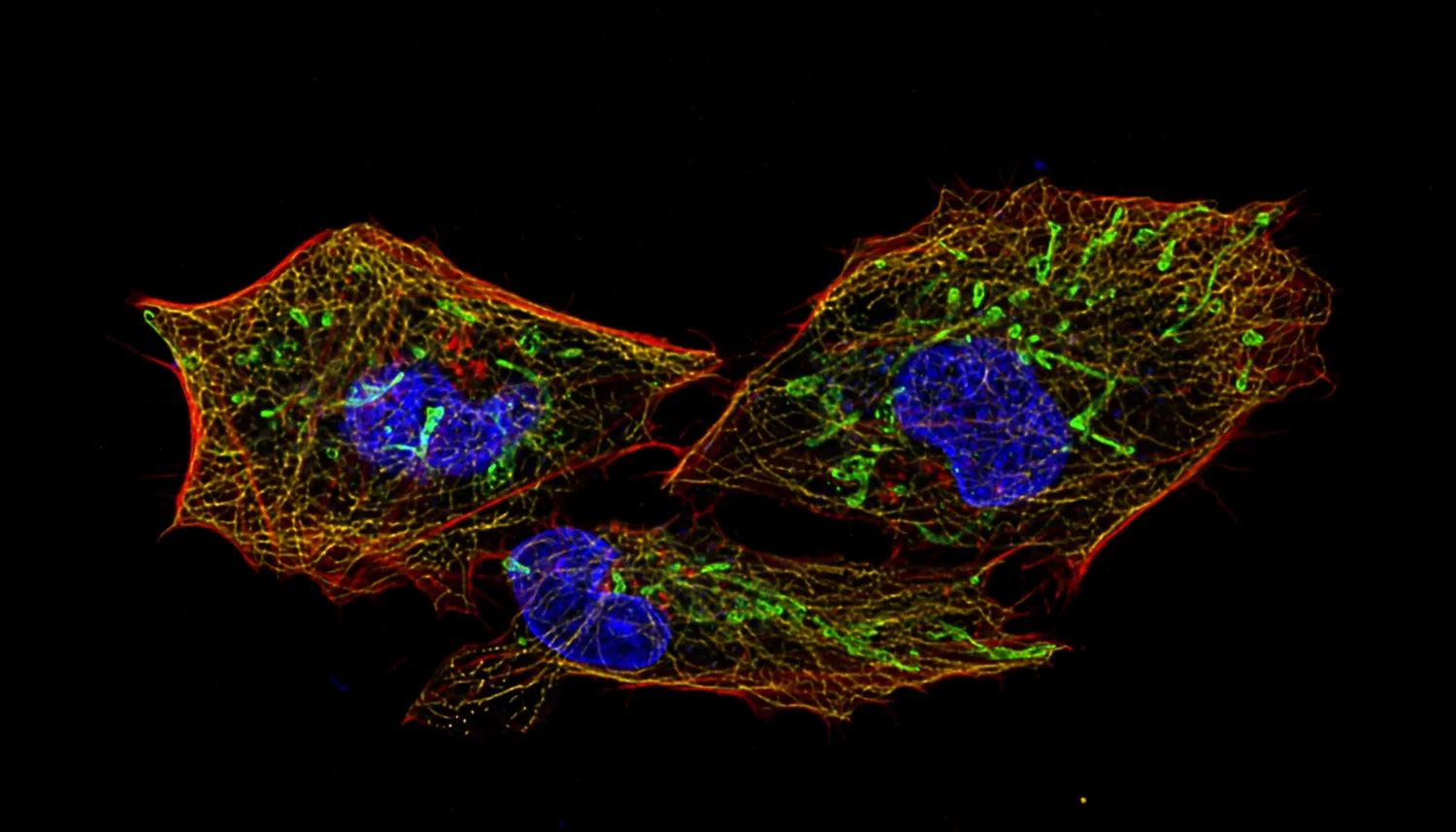 HeLa cells stained for actin, microtubules, mitochodria and cell nucleus and imaged with DeepSIM