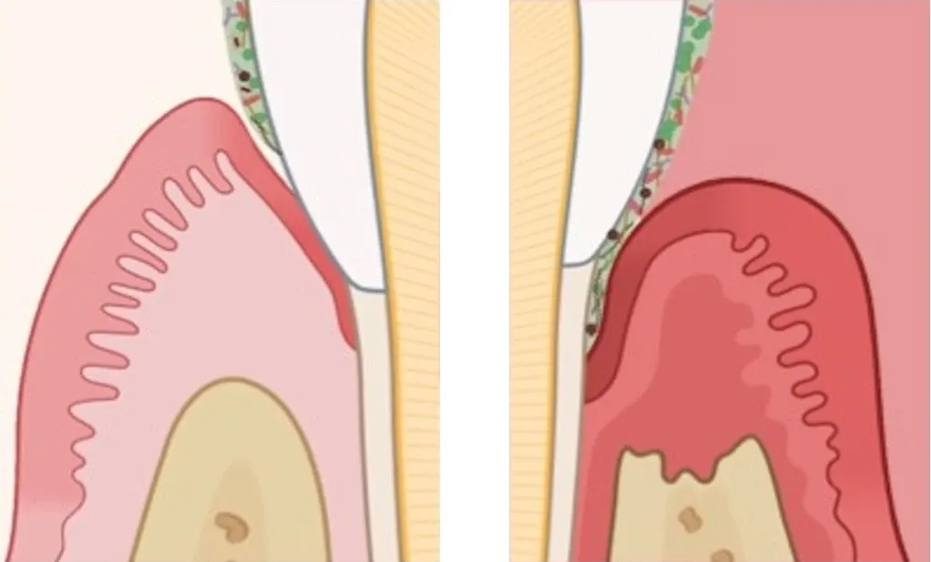 illustration oral hälsa och parodontologi