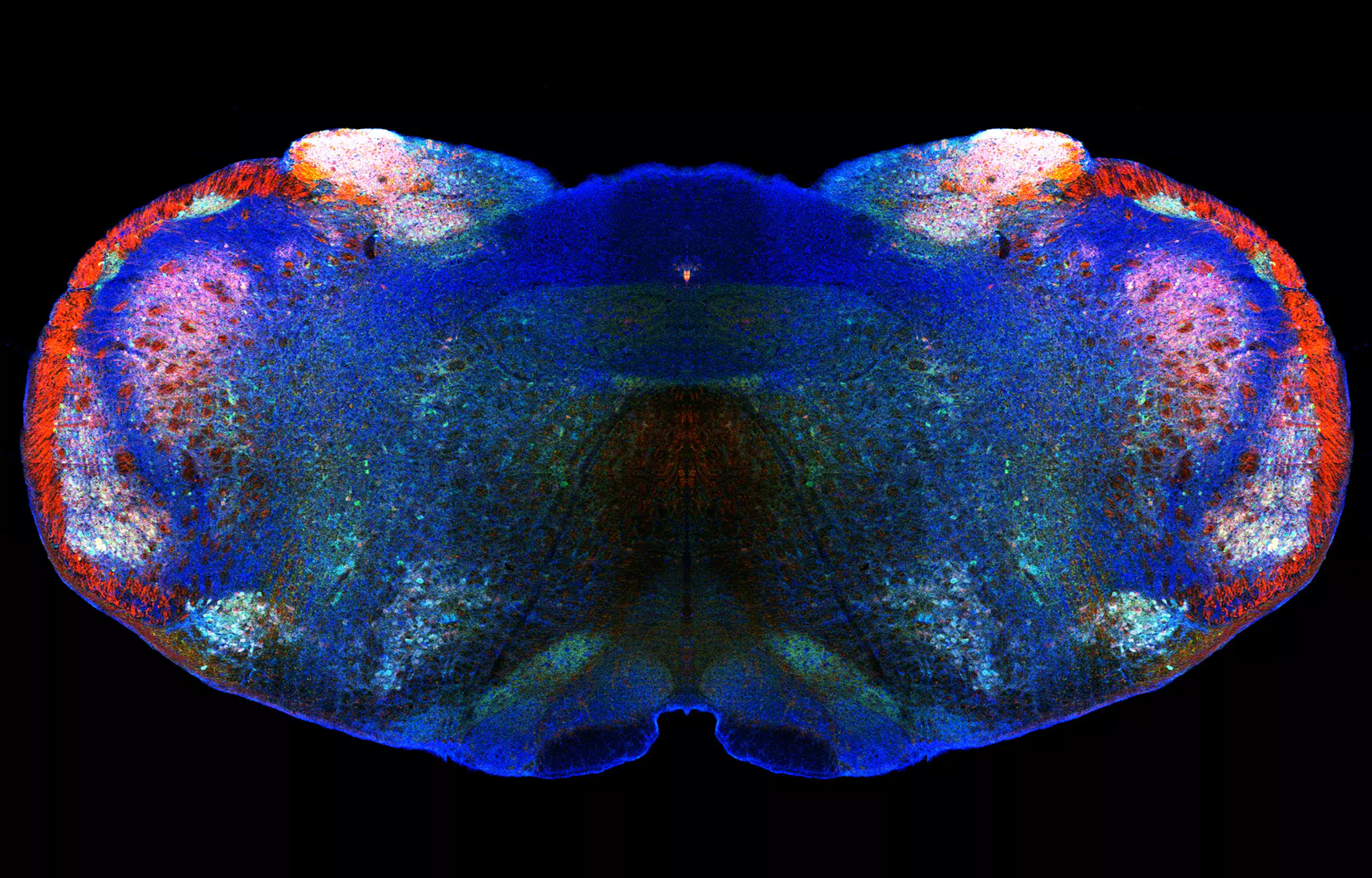 Illustration av hjärnbalk