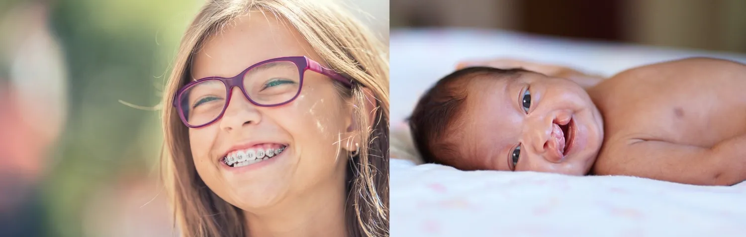 ett barn med gomspalt och en flicka med tandställning