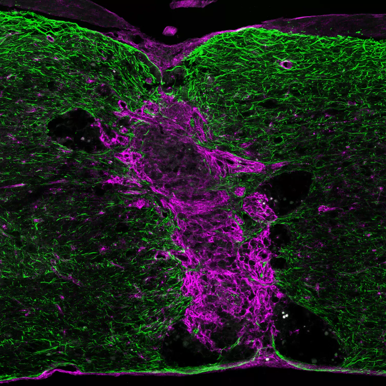 Confocal image of spinal cord full crush lesion
