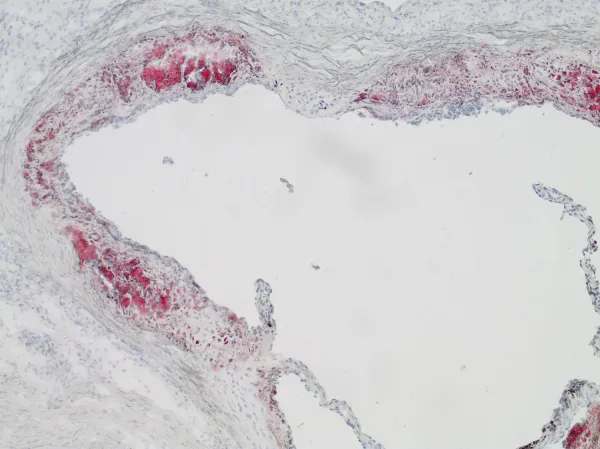 Heart root mouse, 10x magnification.