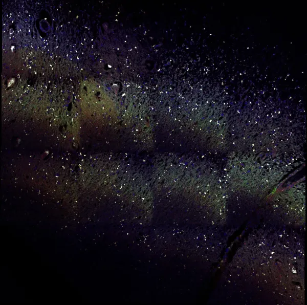 Multiplex RNAscope on human brain with MS