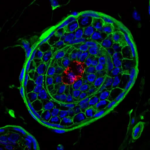 Growing hair: crosssection || Growing hair: crosssection