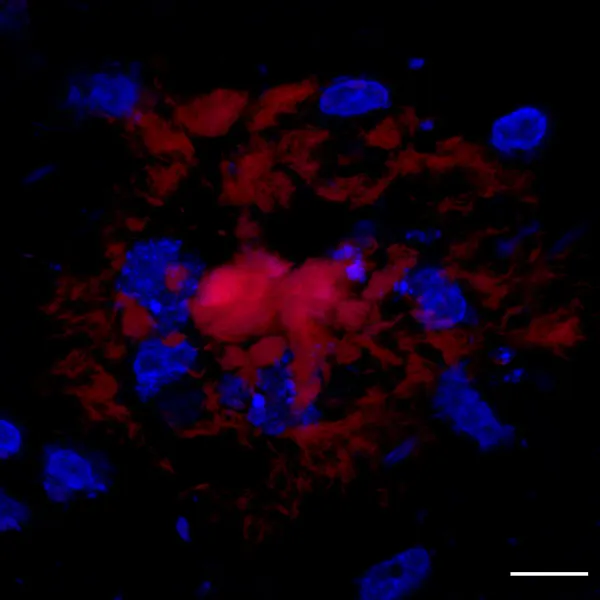 Image created with microscopes in BIC.