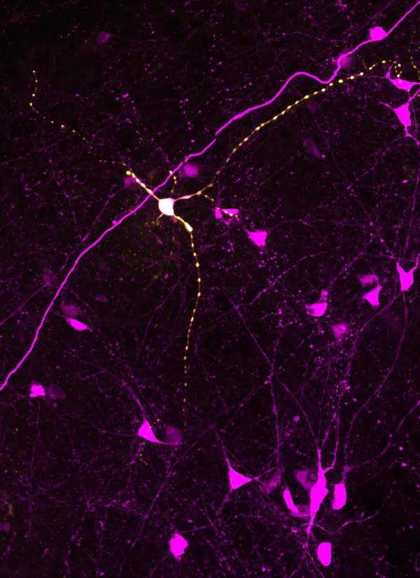 Image created with microscope in BIC.