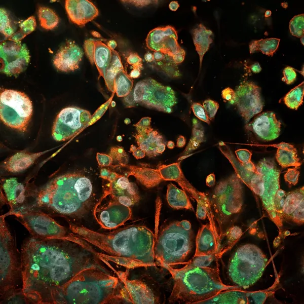 Image created with microscopes in BIC.